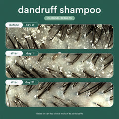 Verb Dandruff Shampoo clinical scalp results shown before use and after 1 and 21 days