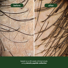 Before-and-after microscopic comparison of hair showing increased visible density after a 20-week study using the Verb Density Peptide Collection