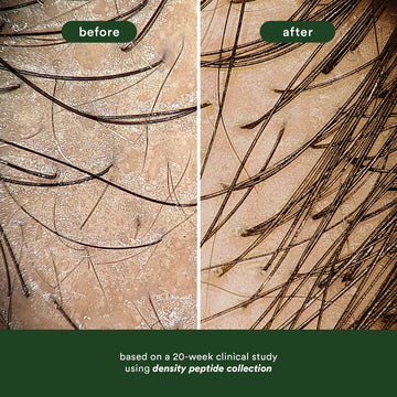 Before-and-after microscopic comparison of hair showing increased visible density after a 20-week study using the Verb Density Peptide Collection