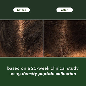 Before-and-after scalp comparison from a 20-week clinical study using the Verb Density Peptide Collection